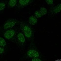 SUMO-2/3, Mouse anti-Human, Clone: 8A2, Millipore Sigma 25&mu;g; Unconjugated:Antibodies,